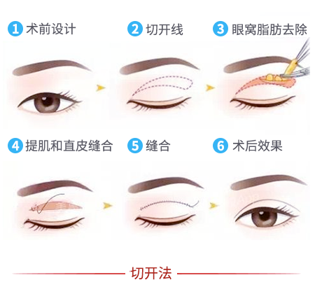 糖尿病眼底病变文章推荐